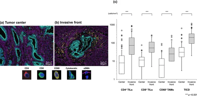 Takahashi et al., Cancer Reports; https://doi.org/10.1002/cnr2.70508