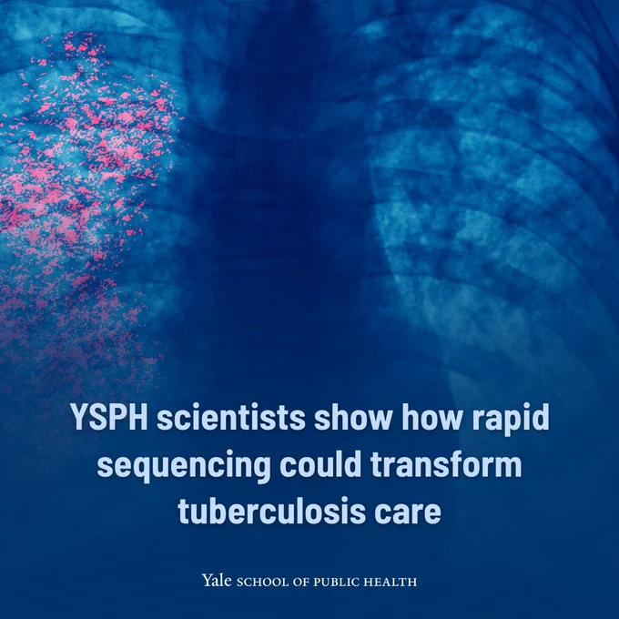 YSPH scientists show how rapid sequencing could transform tuberculosis care
