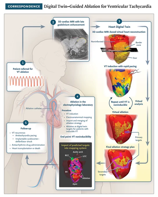 Correspondence
Digital Twin–Guided Ablation for Ventricular Tachycardia

An illustrated diagram of the heart digital twin to guide ischemic VT ablation.