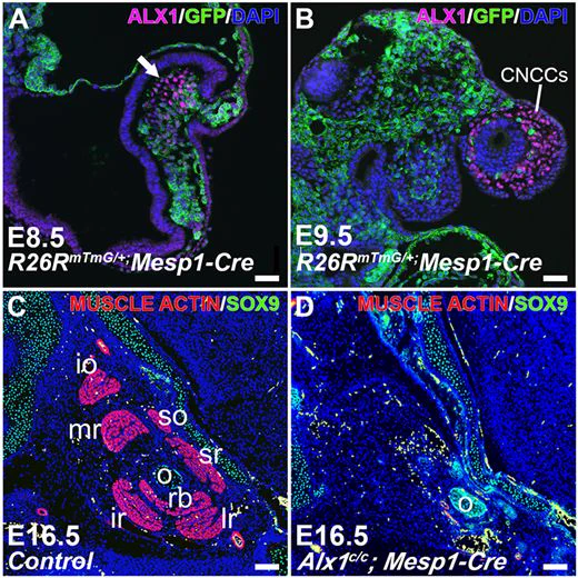 Microscopy images showing that transient mesodermal Alx1 expression is essential for extraocular muscle (EOM) myogenesis. Top panels illustrate the transient window of ALX1 expression (magenta) in GFP  cranial mesoderm at E8.5 (left), followed by its shift to neural crest lineage cells by E9.5 (right). Bottom panels demonstrate that mesoderm-specific Alx1 inactivation leads to the total loss of all seven EOMs (right) by E16.5, compared to the organized EOMs in controls (left; muscle actin is shown in magenta).