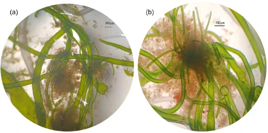 Morphology and microscopic images of the CBC in PBRs treating MWW. (a) The combined form of bacteria and algae; (b) bacterial and algal polymers.