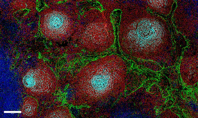 Reactive lymph nodes, as visualised using multiplexed immunofluorescence. B-Cells are shown in red (PAX5), T-cells in blue (CD3), lymphatic endothelial cells and fibroblastic reticular cells in green (PDPN), and follicular dendritic cells in cyan (CD21). Credit: Felix Czernilofsky