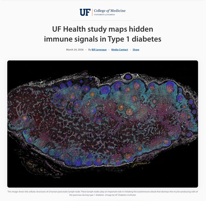 This image shows the cellular structures of a human pancreatic lymph node. These lymph nodes play an important role in initiating the autoimmune attack that destroys the insulin-producing cells of the pancreas during type 1 diabetes. (Image by UF Diabetes Institute)