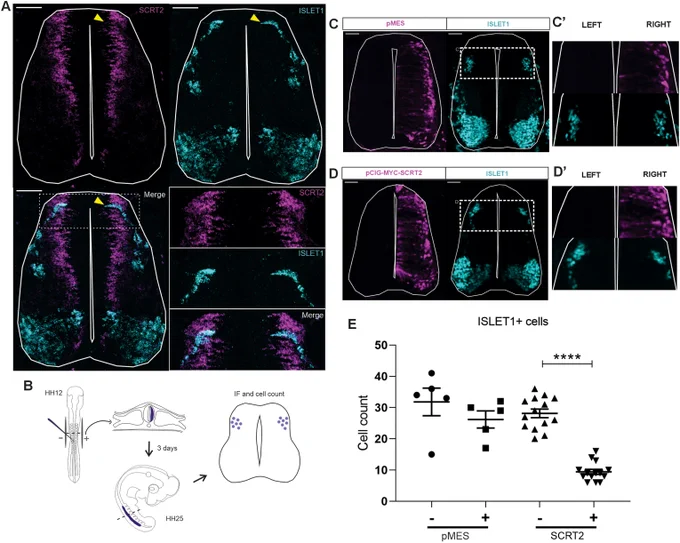 SCRT2 represses ISLET1 expression in the dorsal domain