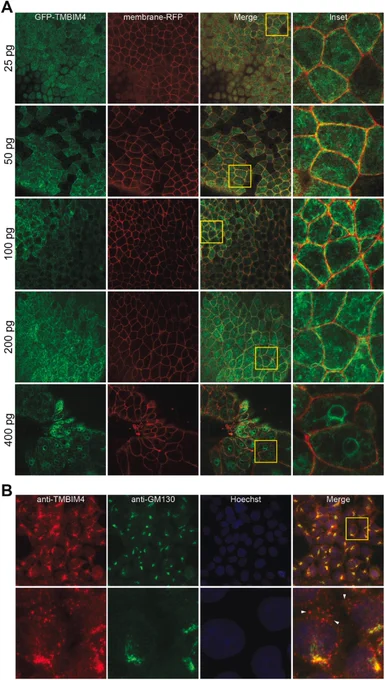 GFP-Tmbim4 localizes to the membrane in Xenopus