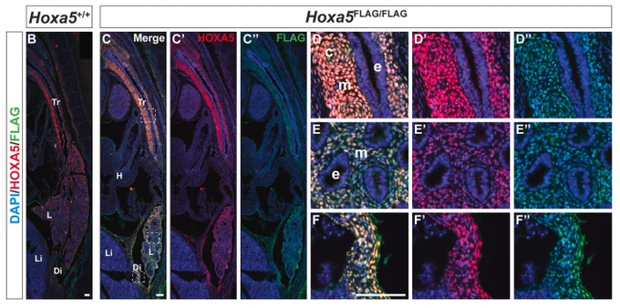 Detection of HOXA5 and HOXA5-FLAG proteins by immunofluorescence for E15.5 wt (B) and Hoxa5FLAG/FLAG mouse embryos (C-F)