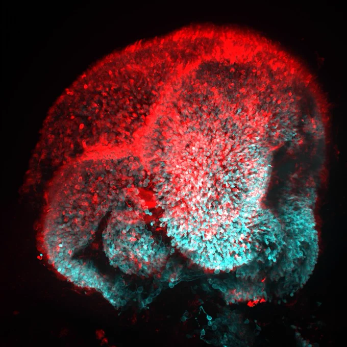 3D stained human organoid.
© IOB, 2026