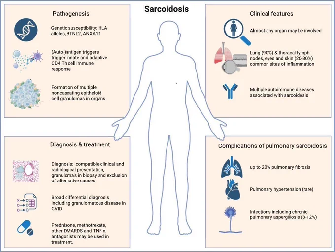 Miedema J, Nunes H, Dalm VASH, Judson MA, Spagnolo P. Sarcoidosis: Disease mechanisms, diagnostic pathway and treatment. Autoimmun Rev. 2026 Mar;25(3):103993. doi: 10.1016/j.autrev.2026.103993. Epub 2026 Feb 4. PMID: 41651390.