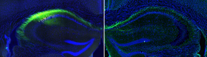 Hipocampos de ratón con las conexiones neuronales (verde) que conectan ambos hemisferios. / IN-CSIC-UMH