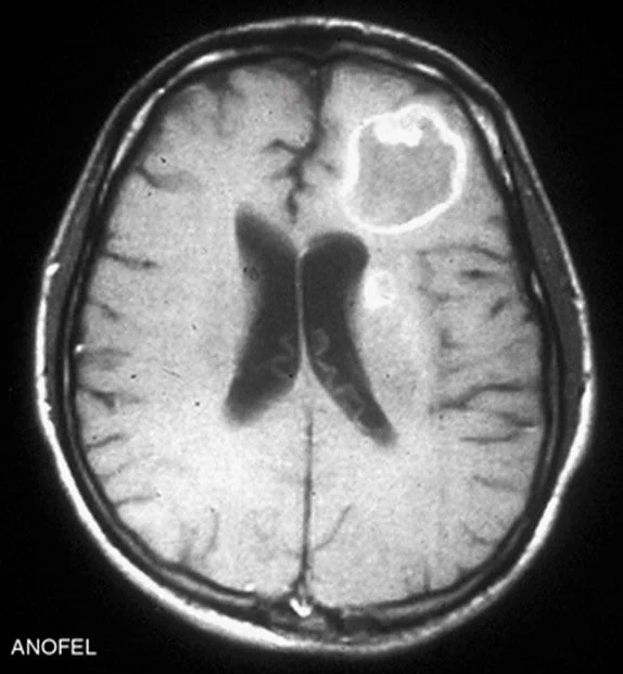 https://www.sciencedirect.com/science/article/abs/pii/S1636541009705264