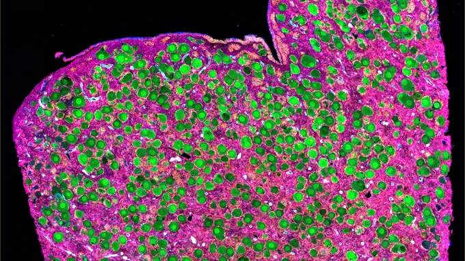 CODEX image of oocytes in a healthy human ovary.
 
Green – oocytes, Pink – extracellular matrix, Cyan – vessels, Blue and Yellow – epithelial cells
 
Photo credit - UPenn & Lurie Children’s (O’Neill, Kim, Laronda)