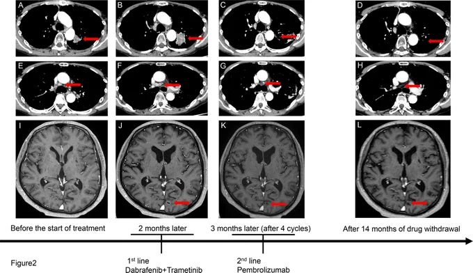 Okayama et al., Cancer Reports, 2026; https://doi.org/10.1002/cnr2.70533