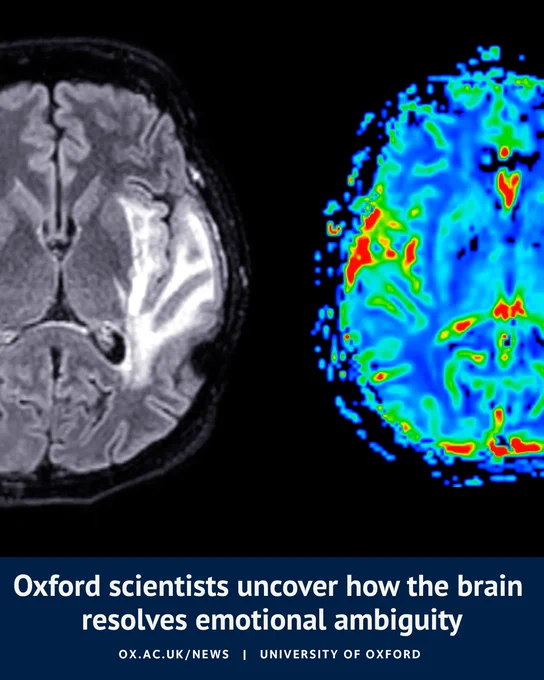 Side-by-side brain scans: a grayscale MRI image on the left and a coloured heatmap on the right showing areas of activity. Overlaid text reads: “Oxford scientists uncover how the brain resolves emotional ambiguity” with University of Oxford branding.