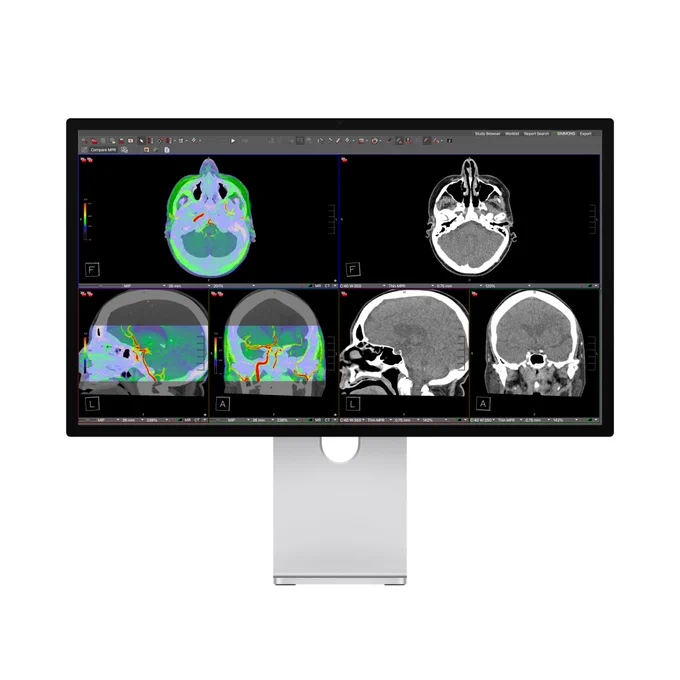Studio Display XDR shows the Medical Imaging Calibration app with multiple brain CT scan views, including grayscale and color-highlighted.