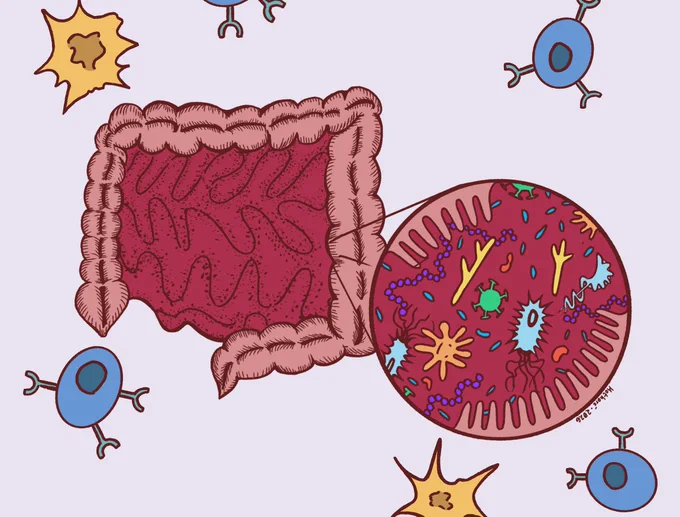 Illustration of a gut filled with microorganisms with a background of cancer and immune cells