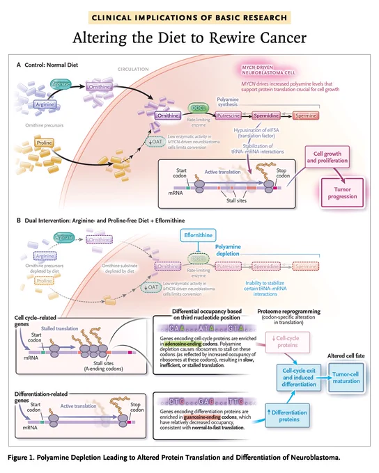 Clinical Implications of Basic Research
Altering the Diet to Rewire Cancer

Figure 1. Polyamine Depletion Leading to Altered Protein Translation and Differentiation of Neuroblastoma.