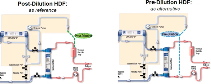 Dilution Modes in Hemodiafiltration. Released under a CC BY 3.0 license from Imamovic et al