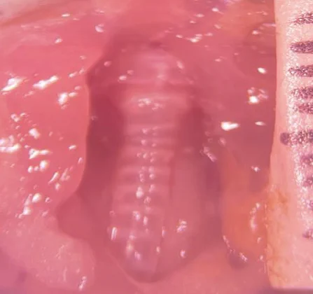 Normal thyroid gland from a control mouse.