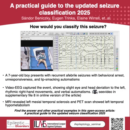 Getting seizure classification right is essential — it guides treatment decisions and informs prognosis. Clinicians involved in epilepsy care should stay aligned with the latest ILAE seizure classification. To deepen your understanding, read the open-access article:

A practical guide to the updated seizure classification 2025

🔗[https://doi.org/10.1002/epd2.70110 ]

#Neurology #Epilepsy #ClinicalCase #MedEd #Seizureclassification