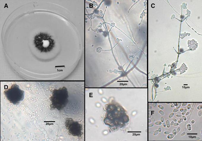 Though you can’t see this type of life in soil with your eyes, they are an active part of the soil food web. Views of a soil fungal pathogen of potato, Verticillium dahliae, isolated from Manitoba fields. (A) Colony of the fungus after placement of a single spore onto potato dextrose agar 18 days earlier. (B) and (C) Conidiophore and whorl phialide bearing dispersal cells called conidia. (D) and (E) Clusters of fungal cells with darkened pigmentation for survival in harsh conditions of soil called Microsclerotia. (F)
(Alt Tex) Views of fungi described in the caption - some have "stems" and things that look like flowers, others are circular or oval clumps and single organisms