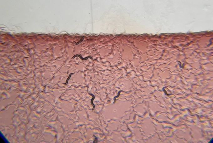 Little worms wriggle through a red-tinted gel.