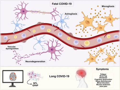 Severe COVID-19 is associated with vascular dysregulation and chronic neuroinflammation, leading to axonal injury and neurodegeneration. In long COVID or PASC, persistent alterations in neuroimaging and biofluid biomarkers reflect ongoing neuronal damage and neuroinflammation, contributing to long-term neurological symptoms including fatigue, cognitive dysfunction, and mood disorders.