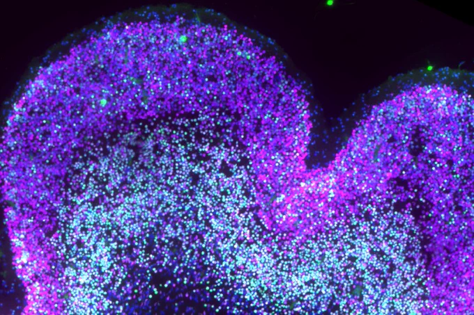 Developing neocortex in Down syndrome. IT neurons are labeled in magenta and deep-layer neurons in green. IT and double-positive neurons are increased in DS at this stage. | Credit: de la Torre-Ubieta Lab