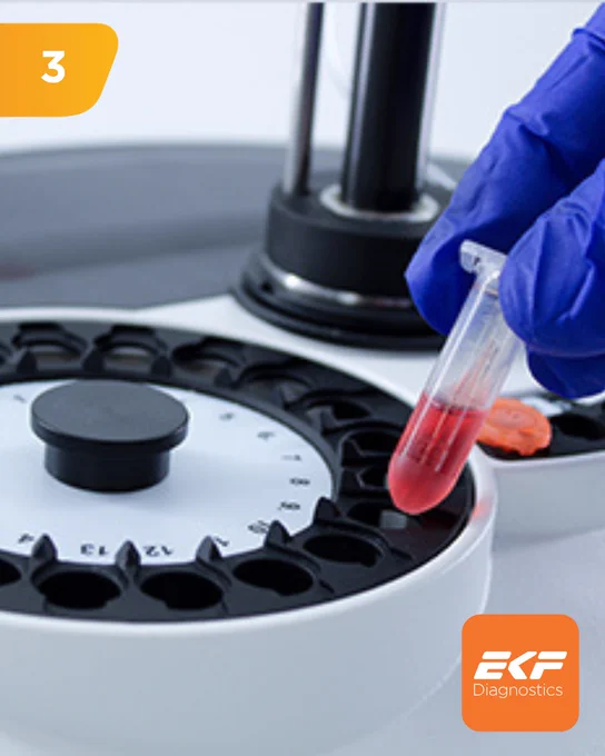 Gloved hand placing a blood sample tube into a laboratory centrifuge for analysis.