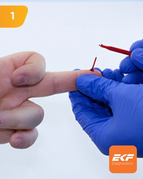 Gloved hand holding a lancet to prick a finger for blood sample collection.