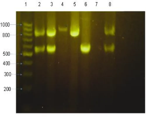 Agarose gel electrophoresis of PCR products: 1, ladder (base pairs); 2 and 8, positive controls for duplex of TEM and CTX; 7, negative control; 3, sample containing TEM and CTX; 4, SHV alone; 5, TEM alone; 6, CTX alone.