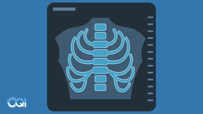 Chest x-ray