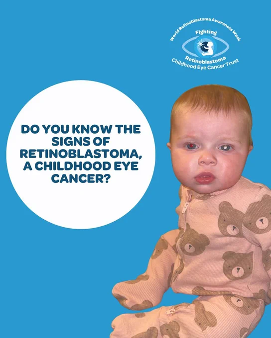 Awareness graphic on a blue background featuring a baby with a white glow visible in one eye. Text reads: "Do you know the signs of retinoblastoma, a childhood eye cancer?" World Retinoblastoma Awareness Week logo from the Childhood Eye Cancer Trust in the corner.