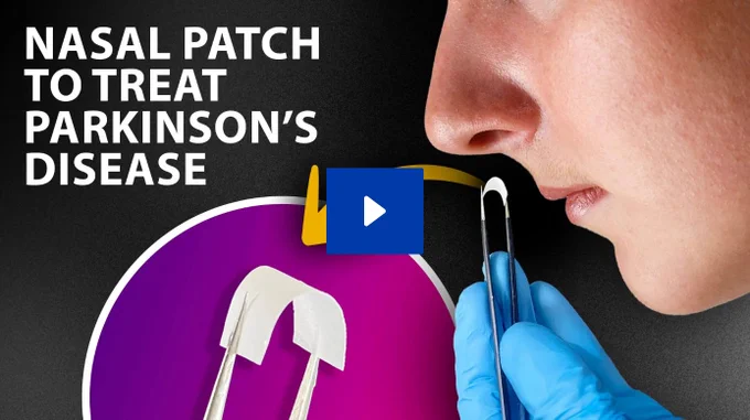 Researchers publishing in ACS Nano produced an intranasal conformal patch designed for sustained levodopa delivery and reactive oxygen species scavenging in Parkinson’s disease.