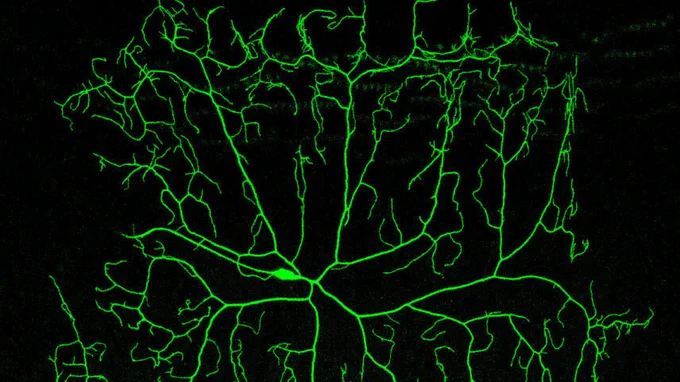 A fluorescent microscopy image shows a complex network of glowing green blood vessels against a dark background. The intricate branching pattern resembles tree branches spreading outwards.