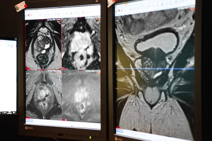 Two medical monitors display MRI scans. The left screen shows a grid of four different cross-sectional images of internal body parts. The right screen focuses on one larger, detailed MRI scan.