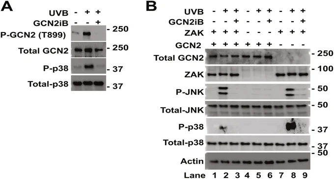 Figure 2. GCN2iB inhibits both ZAK and GCN2 in response to UV irradiation.