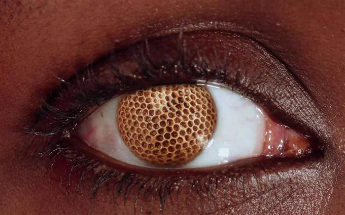 A close up of an eye where the iris is made of a gold metal material.
