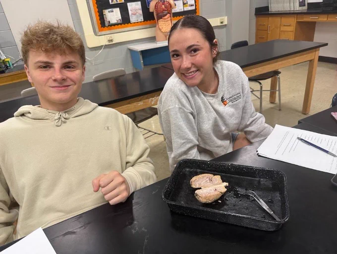 sheep brain dissection