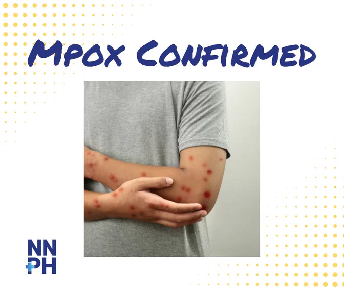 An individual in a gray shirt with red spots on their arm, associated with Mpox. The image includes text reading "MPOX CONFIRMED" and features the NNPH logo in the lower left corner.