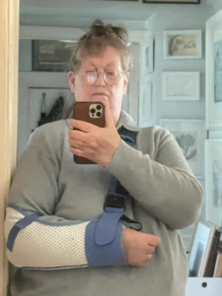 Just dressed and hair put up WHICH TAKES A VERY LONG TIME when done with just one hand and the other arm needs to stay immobilised!