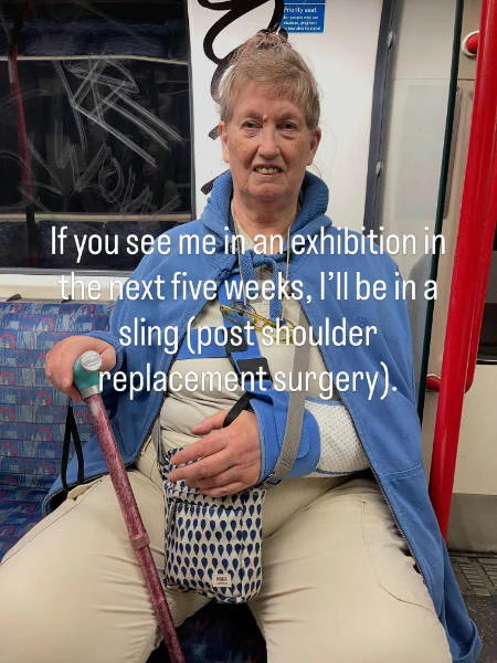 First outing on tube post surgery. My better half draped my my FatFace hoodie on and tied it on. Roka bag does sterling work as extra crutch to rest hand