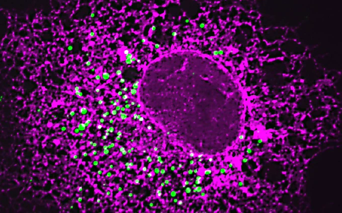 American Scientists Restored Pancreatic Beta Cells that Naturally Produce Insulin and Cured Diabetes Completely