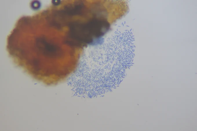 Microscopic image showing orange cane tissue with black fungal fruiting structures called pycnidia on the edge of the tissue. Fungal spores of Botryosphaeria dothidea that are stained blue are releasing from the broken pycnidia.