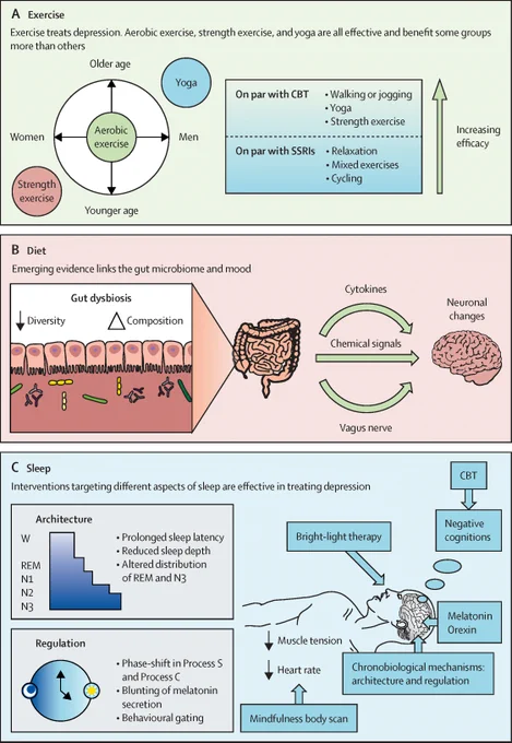 Figure summarising lifestyle modifications used in the treatment of depression.\n(A) Exercise (B) Diet (C) Sleep. Copyright: 2026 The Author(s). Published by Elsevier Ltd. CC BY 4.0.