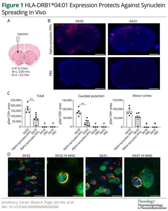 Figure 1 HLA-DRB1*04:01 Expression Protects Against Synuclein Spreading In Vivo
