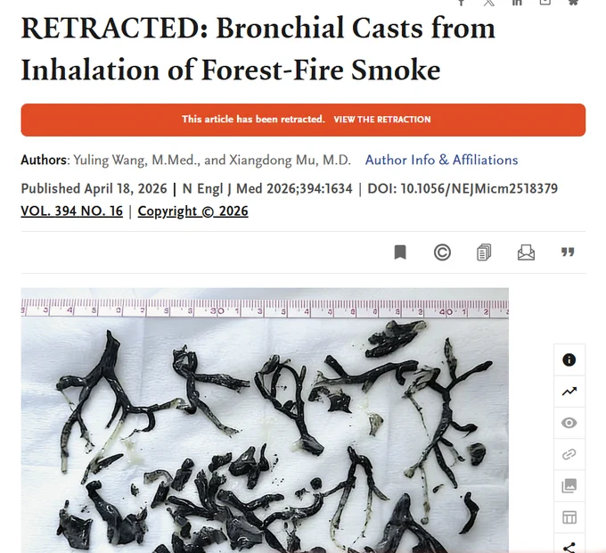 RETRACTED: Bronchial Casts from Inhalation of Forest-Fire Smoke