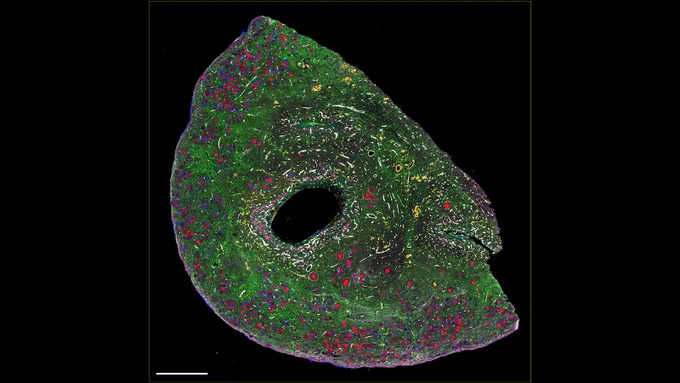 CODEX image of an ovary

follicles - red and blue, luteinizing cells - pink, extracellular matrix - purple, green, white, vessels - yellow and orange