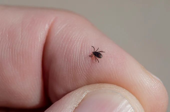 Close-up of a tiny black tick crawling on the skin of a person's finger against a neutral background.