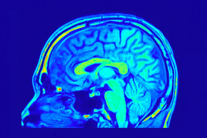 Sagital slice of human brain MRI 