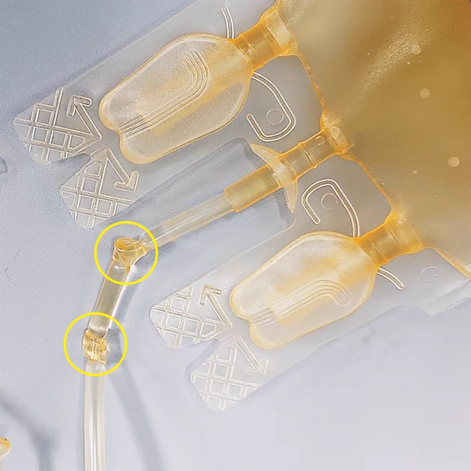 A photo of blood-bag tubes with double-knot closure.